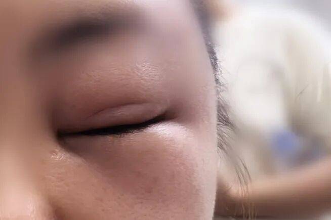 “差点要我命了！”杭州女子在阳台上被突袭！台风前后高发，千万当心，赶紧提醒家人